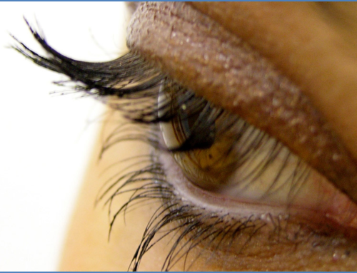 Eyelid surgery / Blepharoplasty